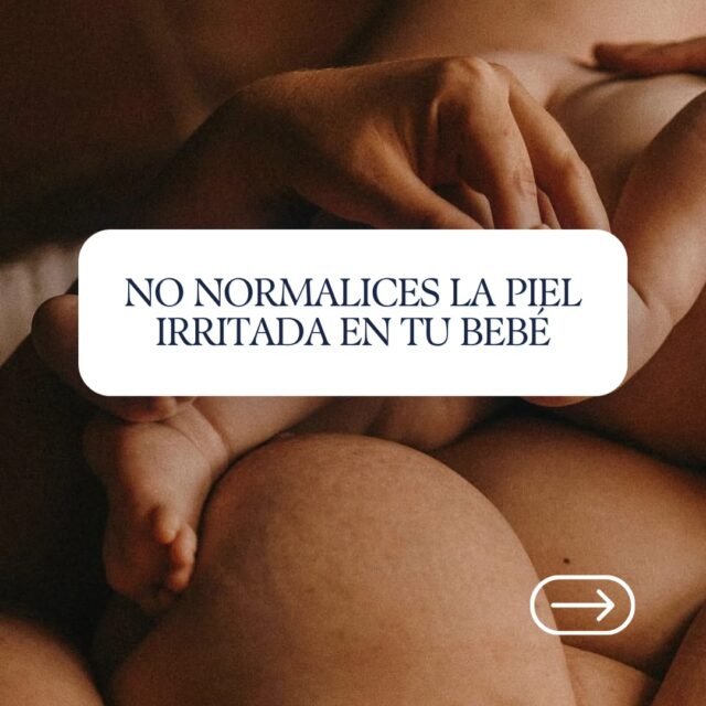No normalices la piel irritada en tu bebé
Durante años nos hicieron creer que las rozaduras, el enrojecimiento y los brotes son una parte inevitable de la infancia. La realidad es muy distinta: la piel de tu bebé no es defectuosa, solo está reaccionando.
Al ser hasta un 30% más delgada que la de un adulto, su barrera cutánea absorbe con rapidez las fragancias sintéticas, sulfatos y conservadores presentes en los productos convencionales. Proteger su salud no requiere rutinas complejas ni decenas de cremas; requiere fórmulas limpias, botánicas y puras que respeten su biología natural. Simplificar su cuidado es el primer paso para devolverle la calma a su piel.
🌿 Desliza para identificar las señales de alerta y aprender a proteger su piel desde el primer día.
👉 Visita elijahandvictoria.com para conocer nuestra línea de productos naturales formulados especialmente para cuidar y proteger la piel de tu bebé.
#cuidadoinfantil #Pieldebebe #MaternidadConsciente #ElijahAndVictoria